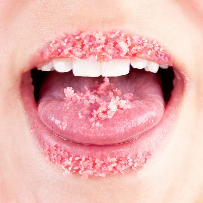 bonbons-petillants-pasteque-explosive-kiss (1).webp